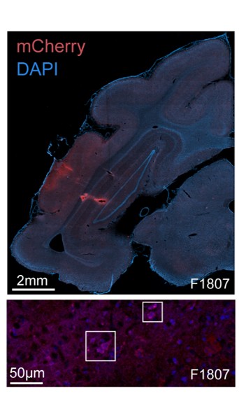 In vivo Electrophysiology